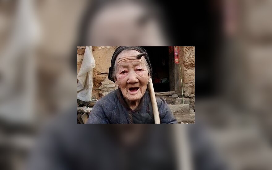 У 103-летней китаянки растут рога