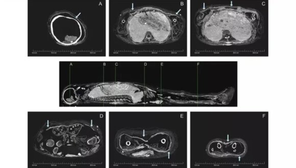 Archaeologists were surprised by the discovered mummy: They admitted that they had never seen it before