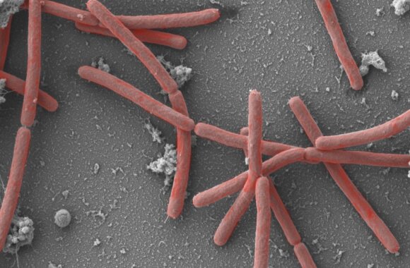 Bakterier som lever av hydrogen og karbondioksid.  Methanothermobacter thermautotrophicus.  Foto av Andreas Klingl /https://vaam.de/en/website-microbiology/microbe-of-the-year/contact-press/press-images/