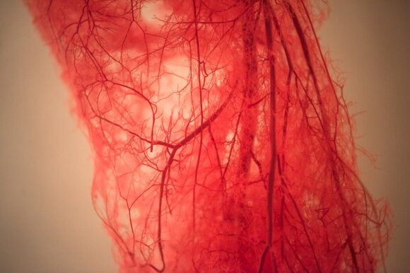 Blood vessels of the legs