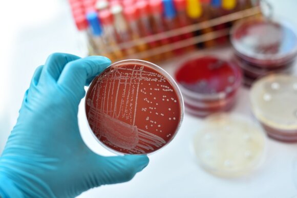Bakterijų sukeltos ligos nusineša milijonus gyvybių kasmet.