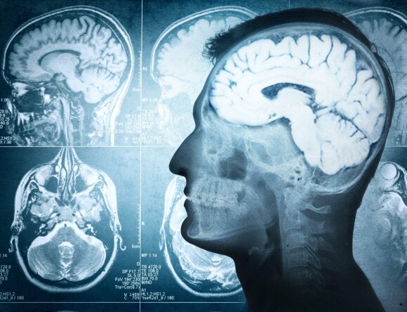 Neurologist: what to take to have a sharp mind until gray old age