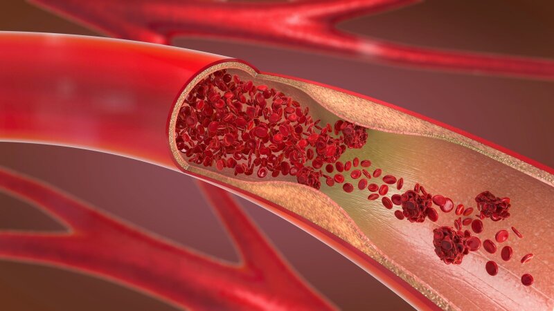 Ką reikia žinoti apie cholesterolį