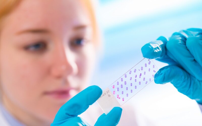 biopsija
