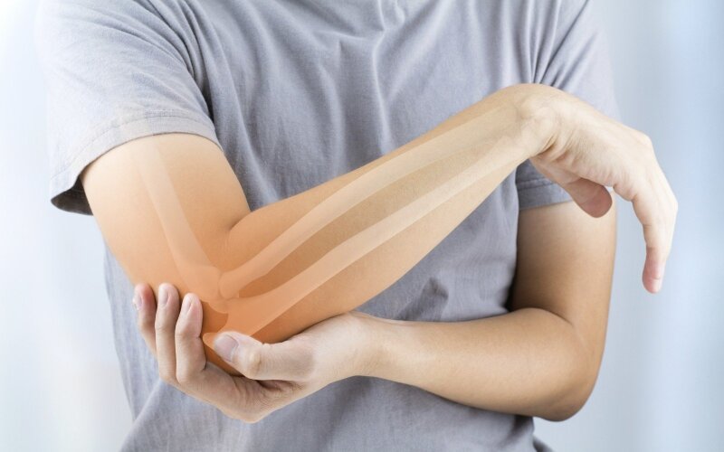 Osteoporozė