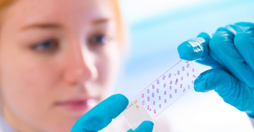 biopsija, 3 puslapis - išsamiai DELFI.lt