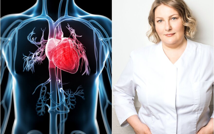Santaros klinikos gydytoja kardiologė Milda Kovaitė papasakojo apie širdies ligas