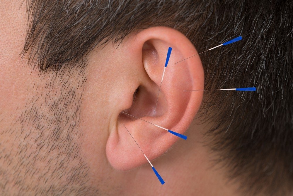 Ūžesys ausyse: diagnostika ir gydymas – Medpraktika
