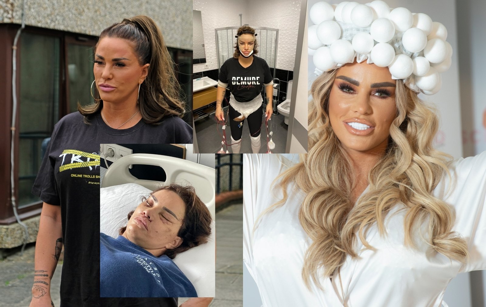 Priestaringai Vertinama Katie Price Ryzosi Dar 5 Plastinėms Operacijoms Paviesinti Vaizdai Kelia Klausima Ar Tai Tikrai Ji Delfi Veidai